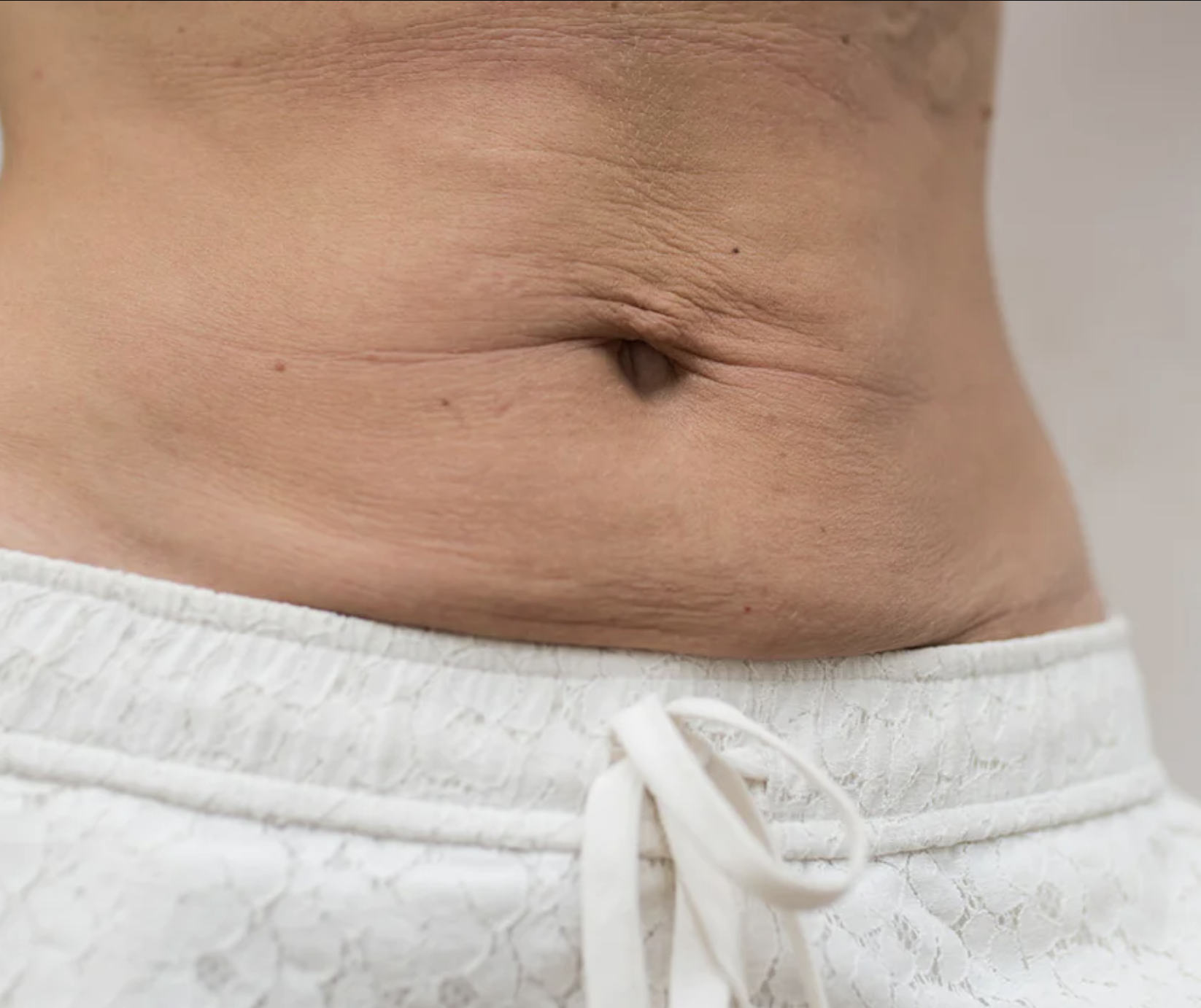 Pregnancy and Loose Skin